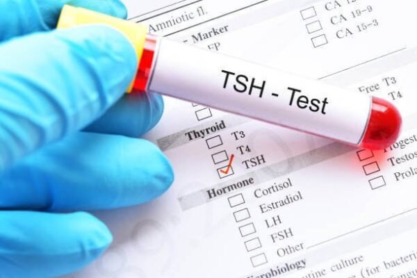 TSH